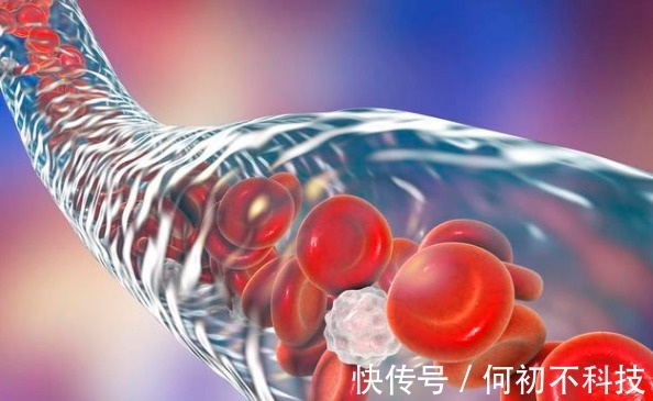 血糖监测|糖尿病人停药后发现血糖也不高了是什么原因本文为你分析实情