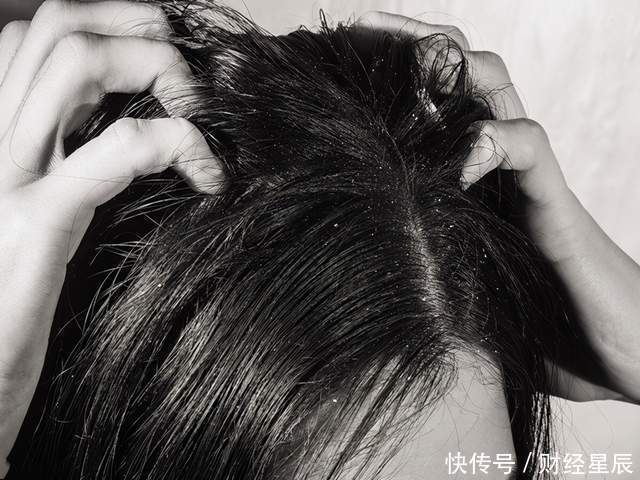 慢慢|养肝“领头羊”发现了,不是蒲公英,平时可劲吃,肝病慢慢远离你
