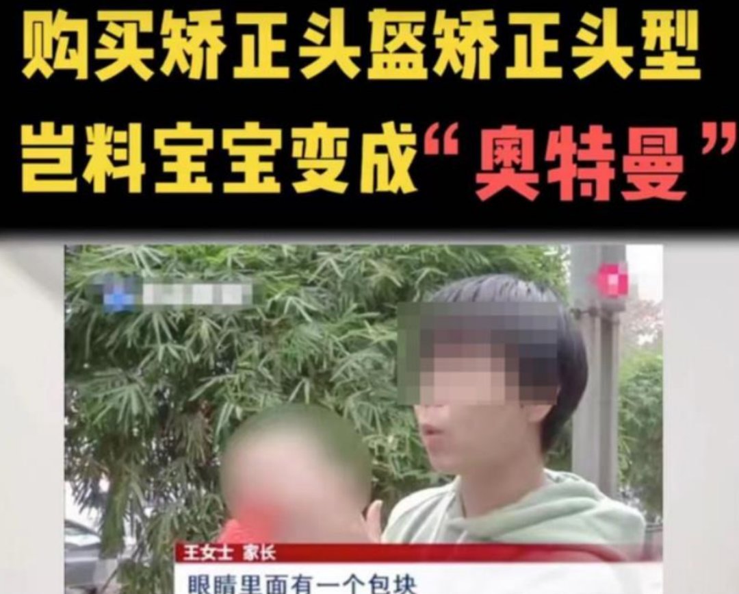 发育不良|婴儿头型矫正？该矫正“畸形育儿观”了