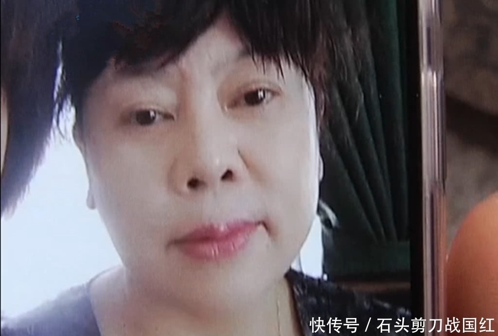 整形手术|奇闻:大妈做拉皮手术,术后却成了面瘫 医院:俺不认识她