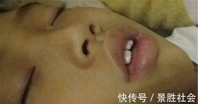 儿子|儿子越长越像“大猩猩”,宝妈调侃长残了,朋友提醒才去医院检查