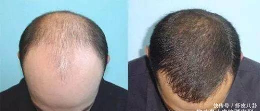 光头|男人过了四十别剃“光头”,三种帅气发型,让油腻大叔变回小鲜肉