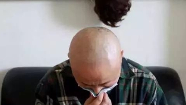 乙肝|有乙肝牢记4个异常,自查发现2个以上,可能肝炎已不是早期