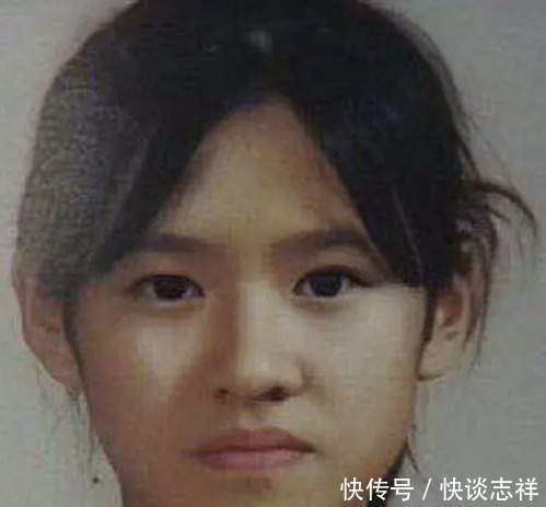 鼻尖抬高,鼻翼惊现疤痕,号称天然美女代名词的她,也翻车了?