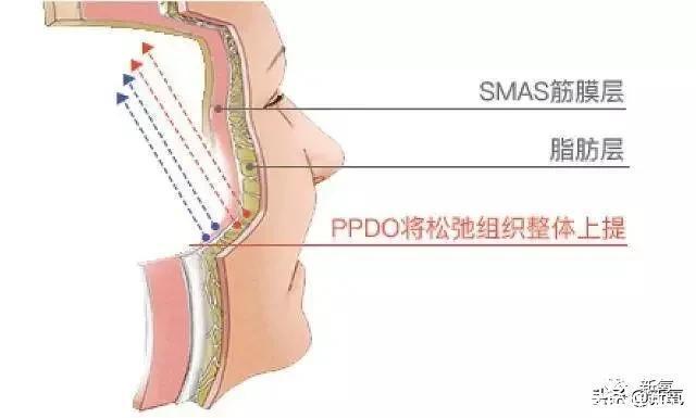 半个娱乐圈女明星脸上都有的这个坑，真的是线雕的锅吗？