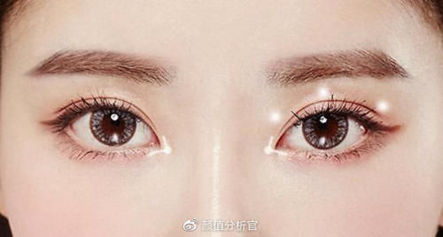 内眼角开太大了怎么办？是缝合好还是皮瓣转移修复好？