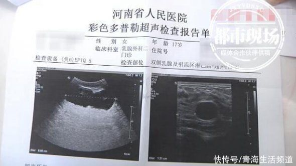 纹唇|17岁少女因自卑隆胸,术后却一边大一边小,美容机构手术没问题