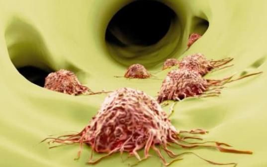 生活环境|生活中不易患癌的人，往往都有几个共性，占上一个也不错！