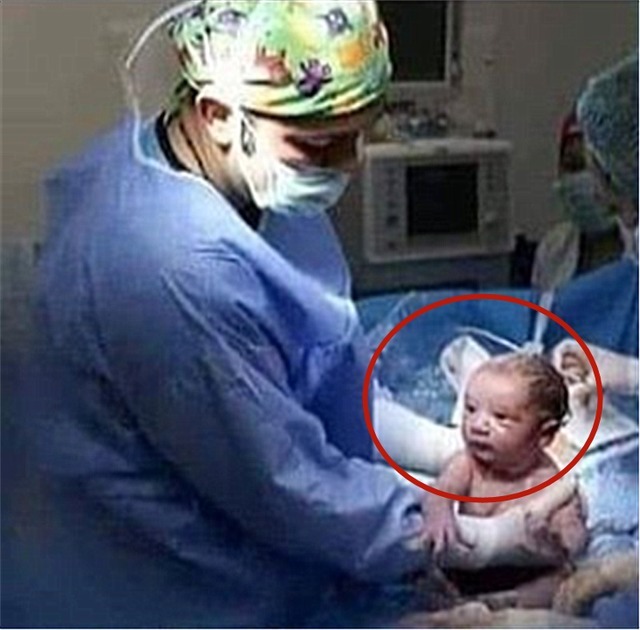 宝宝|“懵圈宝宝”火了,带着一脸茫然的表情出生,网友:这哪像刚出生
