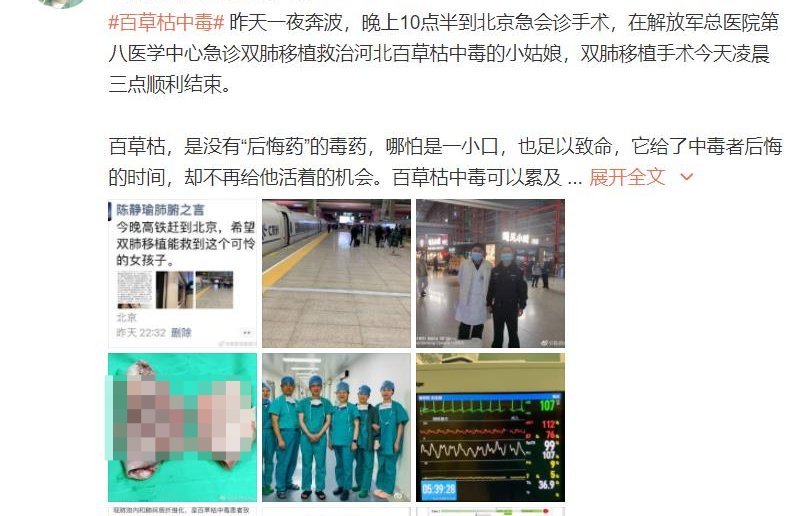 河北省人民医院|被姐夫投毒女孩已完成“肺移植手术”，医生：已苏醒，生命体征平稳