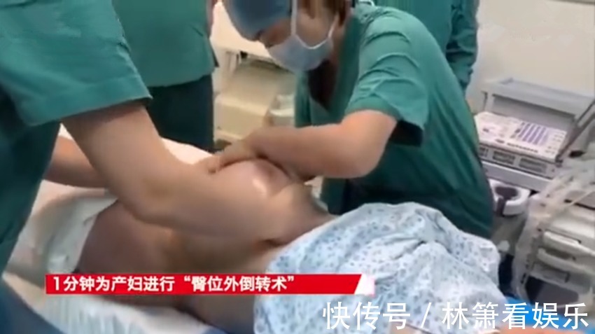 胎位|堪称魔术!1分钟剖宫产变顺产,医院产房上演胎位“乾坤大挪移”