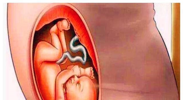暴涨期|胎儿在宫内是如何发育成型的?十张图读懂胎儿发育过程,都该看看