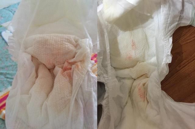 甜菜红素|“妹妹流血啦,妈妈快来”,面对意外,哥哥的反应让医生竖起拇指