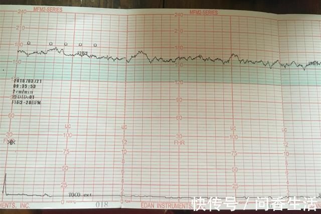胎动|进行胎心监护,一会儿合格,一会儿不合格,是胎儿“缺氧”吗?