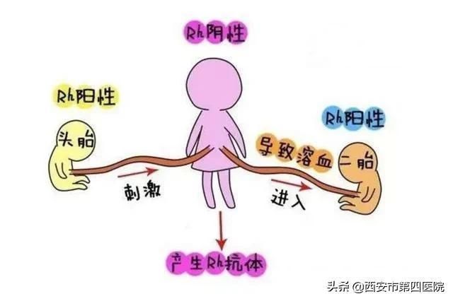 筛查|#健康中国行动2030# 听说过“新生儿溶血病”吗?孕妇产检这项是关键!