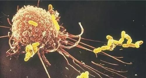 浸润癌|同为癌，原位癌、微浸润癌、浸润癌有何区别？