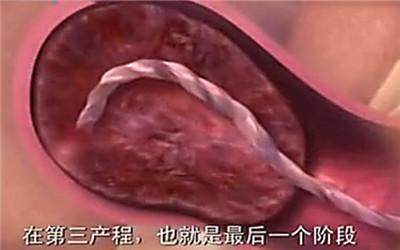 胎头那么大,到底是怎样从那么小的口出来顺产分娩全过程-附图