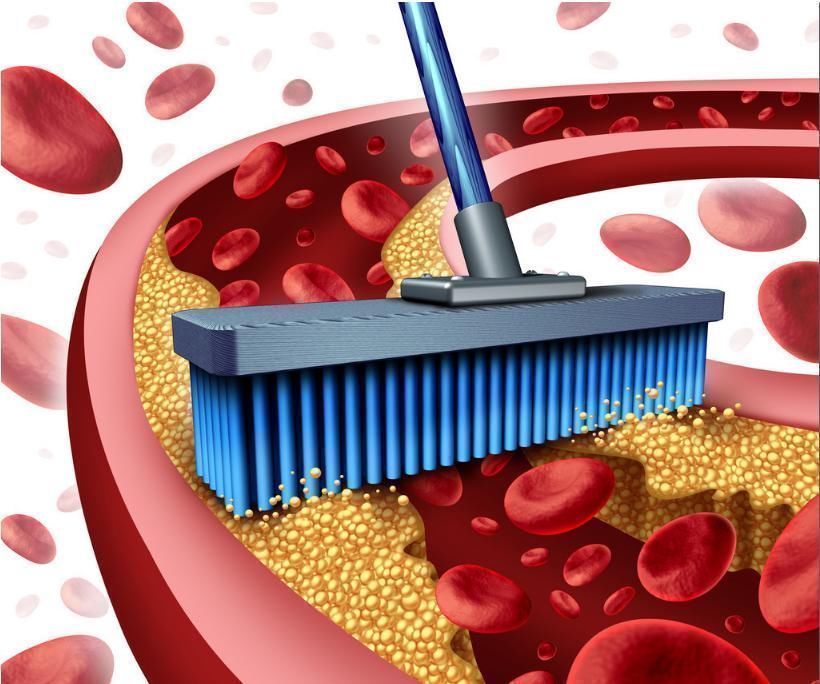 开水|天然“他汀”就在身边,开水里加一点,血管垃圾清光、降低高血脂