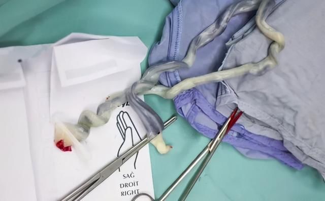 脐带|剪脐带宝宝痛吗？