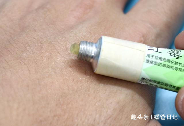 红霉素软膏|红霉素软膏除了药用，还有5个妙用也很棒，叮嘱家人知道，很实用