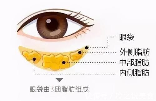 手术|32岁哺乳期女生,分享自己的求美经历:甩掉眼袋和泪沟不烦恼