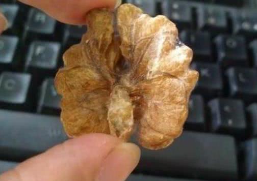 霉菌丝|核桃错误吃法,不仅不补脑,还有致癌的风险!