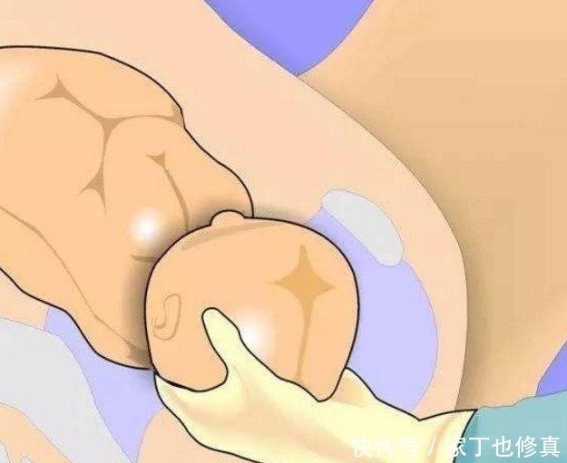 准妈妈|顺产时不顺利的会有哪一些措施,各位准妈妈们了解多少