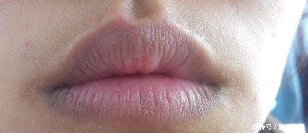 白带异常|女人是否有妇科病,看嘴就知道,健康的女性一般没有这4个异常