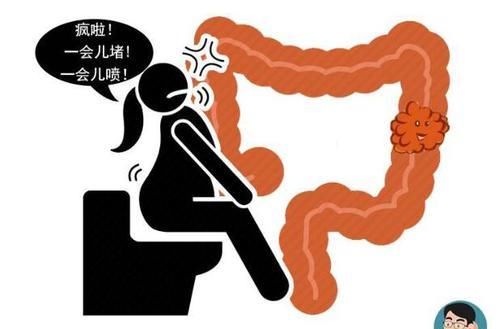  患者|排便若有这5种表现，多半是肠癌发出的求救信号，趁早进行检查