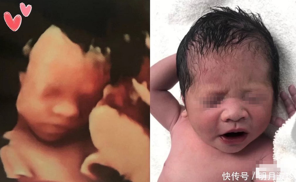 宝妈|有种“暖心”叫胎儿心疼孕妈，用这三种方式默默保护妈妈，感动！