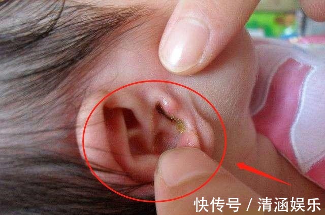 宝宝|2岁宝宝平时一习惯,妈妈送去医院检查,医生还好来得早