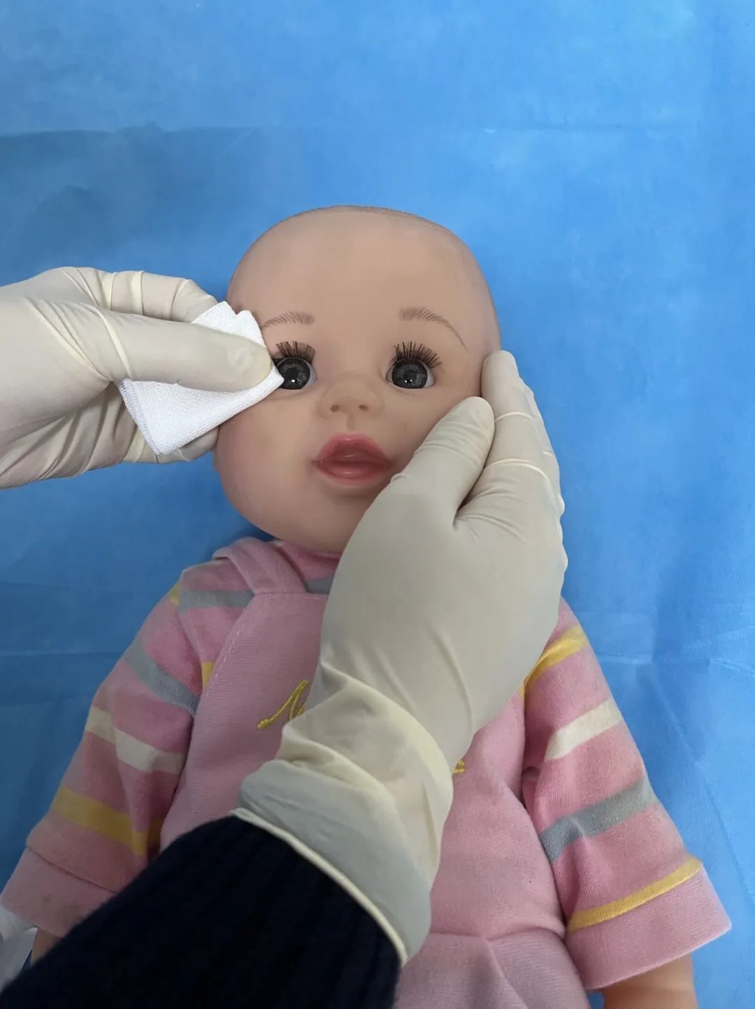 泪道|眼角抽出5管脓液,宝宝眼睛经常“泪汪汪”居然是病!拖延治疗严重的可能失明