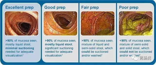 电解质散|肠镜检查前如何清肠，请收下这份最详细的指南