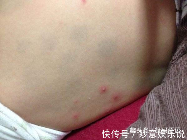 孩子|奶奶天天给宝宝换洗衣服,孩子身上却长小红点,很多家长犯错误