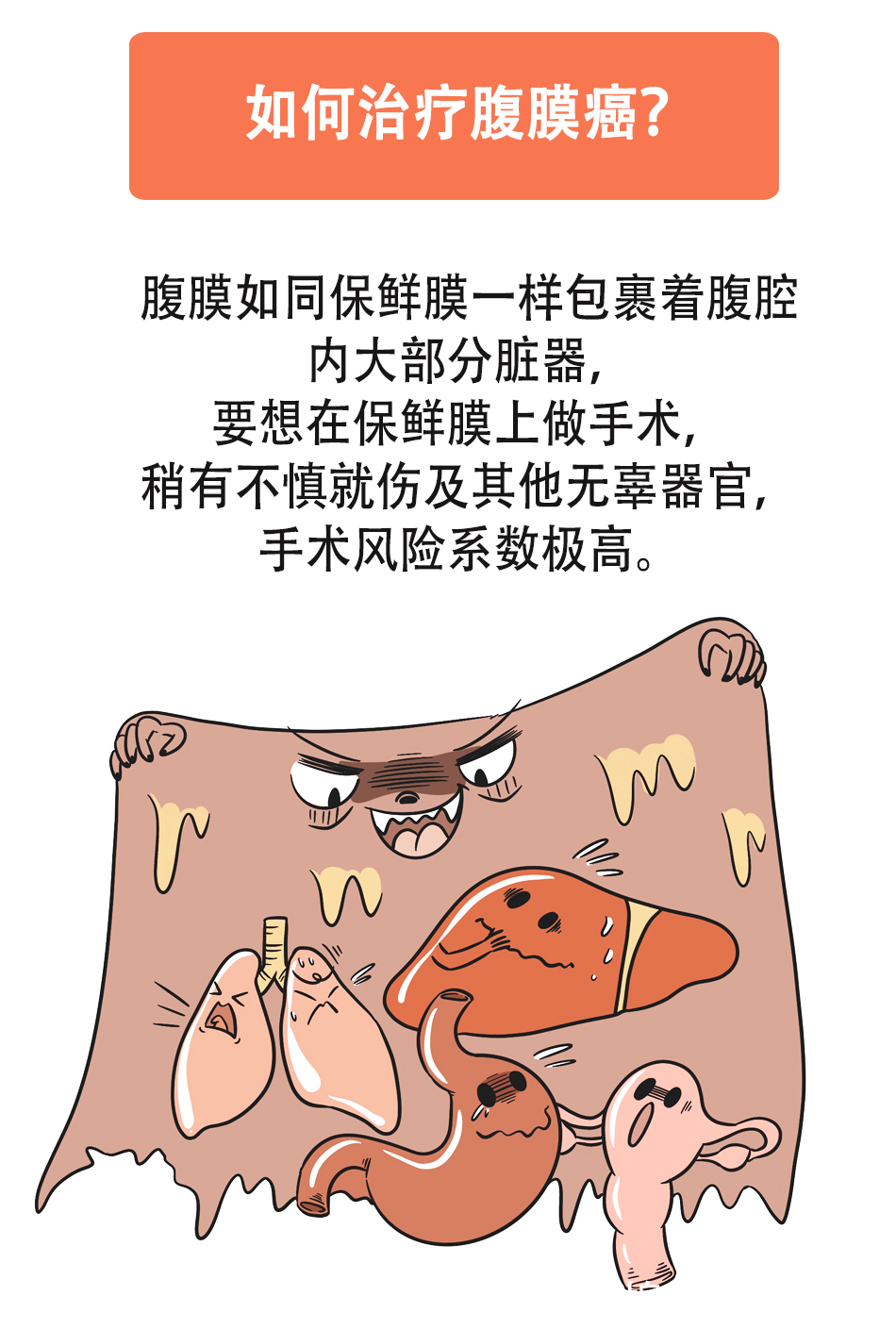 李雁|“老大难”腹膜癌能治吗?