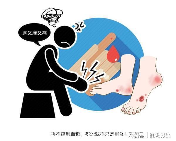 糖尿病并發癥|因糖尿病死亡的人，大多“栽”在5個并發癥上，若發現及時治療