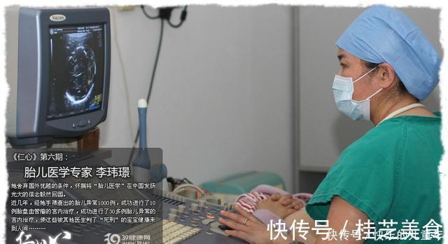 医生|那个被判了“死刑”的孩子,经过她的努力来到了人间