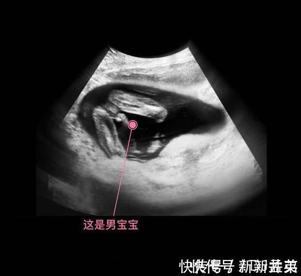 羊水|胎儿从卵泡到性别形成,17张图片清晰诠释,男宝女宝看得很清楚