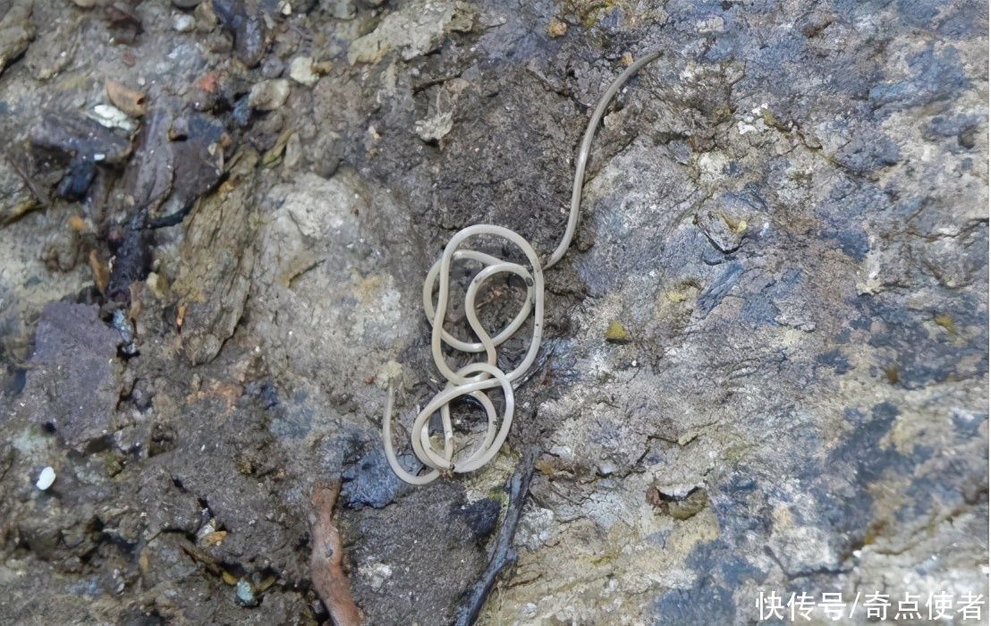 蛔虫|在过去,很多人肚子里都有“蛔虫”,为什么现在却看不到了?