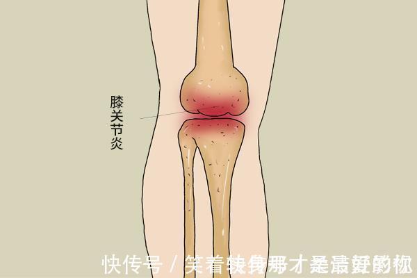 结果|每天坚持晨跑五公里,六旬老人,最后换来了什么结果?