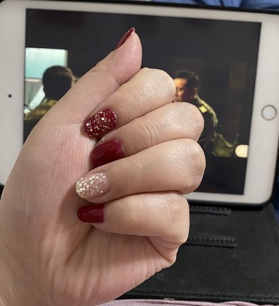 粉碎性骨折 看着都疼!女子意外摔倒致美甲片掀翻指甲