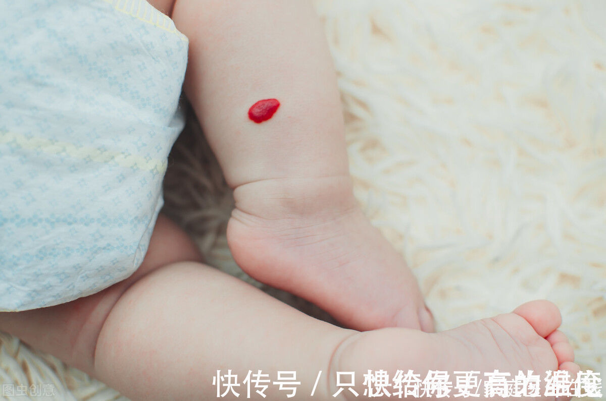 今日头条|血管瘤是怎么回事？需要治疗吗？医生：要根据情况而定