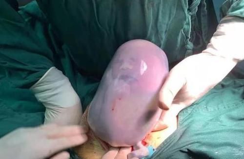 医生|孩子出生自带“金钟罩”,护士连连道喜,产妇:我生了个哪吒?