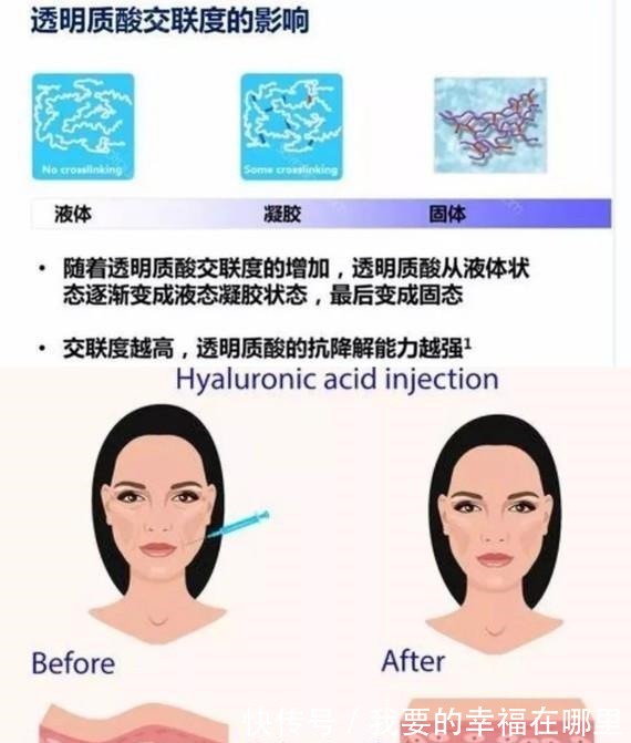 分子量 玻尿酸的前生今世!护肤、口服、医美,竟然连TT里面都有添加!