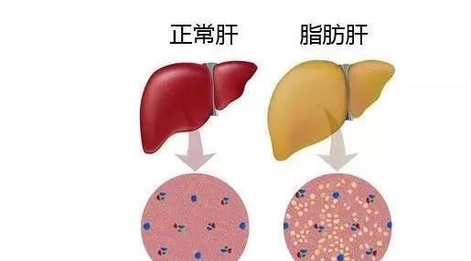  配方|一代名医朱丹溪：一个神通广大的配方！只要用得好，能治10种病！