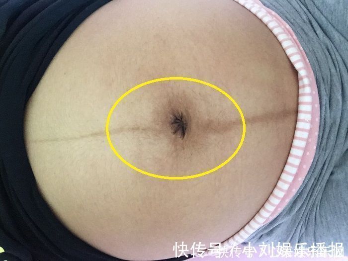 怀孕期间|女性怀孕后,肚脐眼是凸起是凹进,受3个因素影响,别轻易忽视