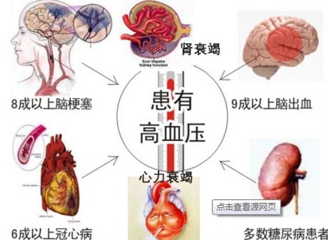 医生|高血压疫苗即将上市，打一针还用吃降压药吗听听医生的答案