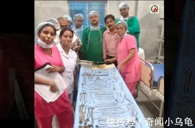 比斯瓦斯|印度一女子身体里竟取出价值45万的珠宝:69条链子,80个耳环