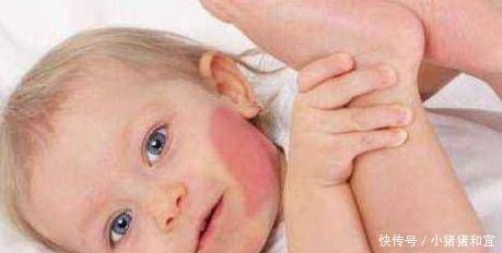 化妆品|怀孕期间,经常做这两件事的孕妈,胎儿容易长胎记,后悔都来不及