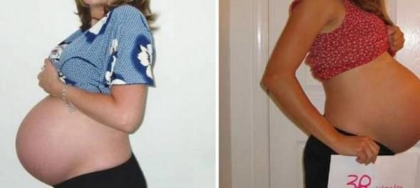 预产期过了4周，孕妇才去医院剖腹产，医生剖开后差点被熏晕